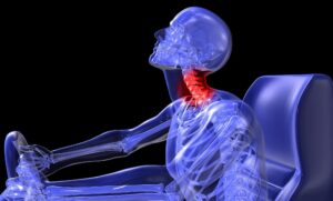 Latigazo Cervical por Accidente de Auto en Chicago